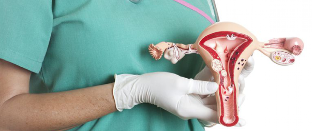 Что делать при опущении стенок влагалища