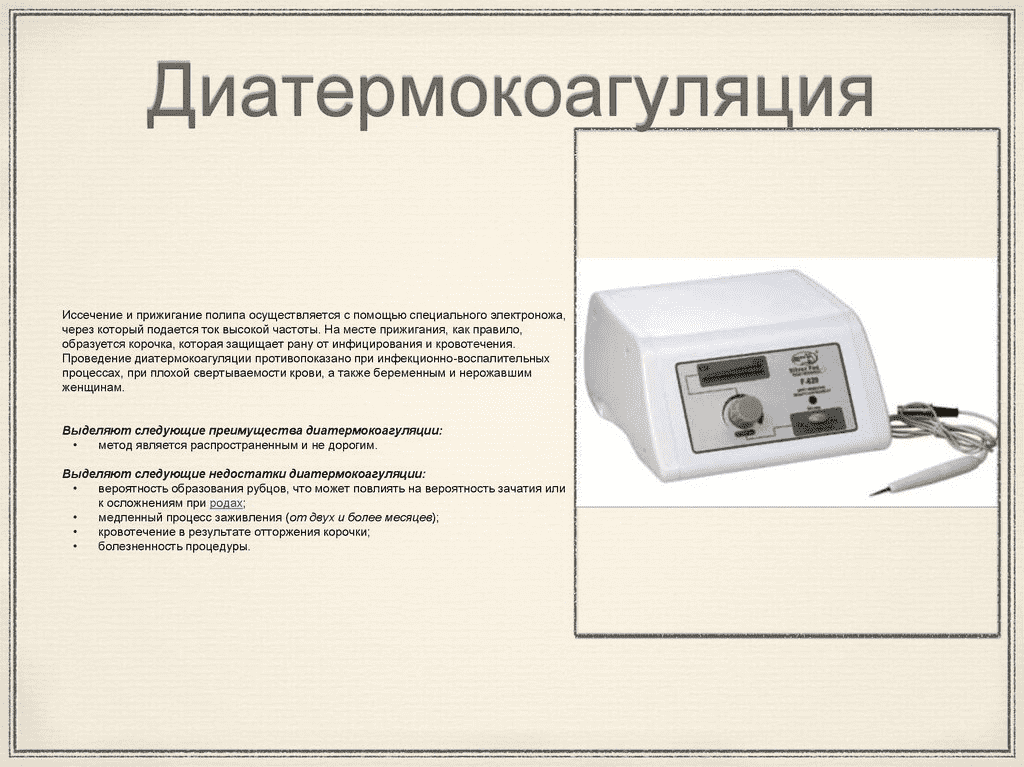 Полип шейки