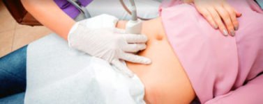 УЗИ при миоме в платной клинике