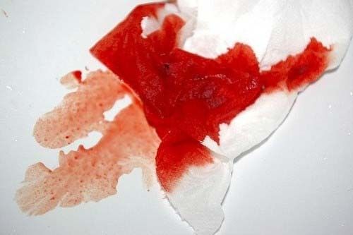 Выделения с кровью