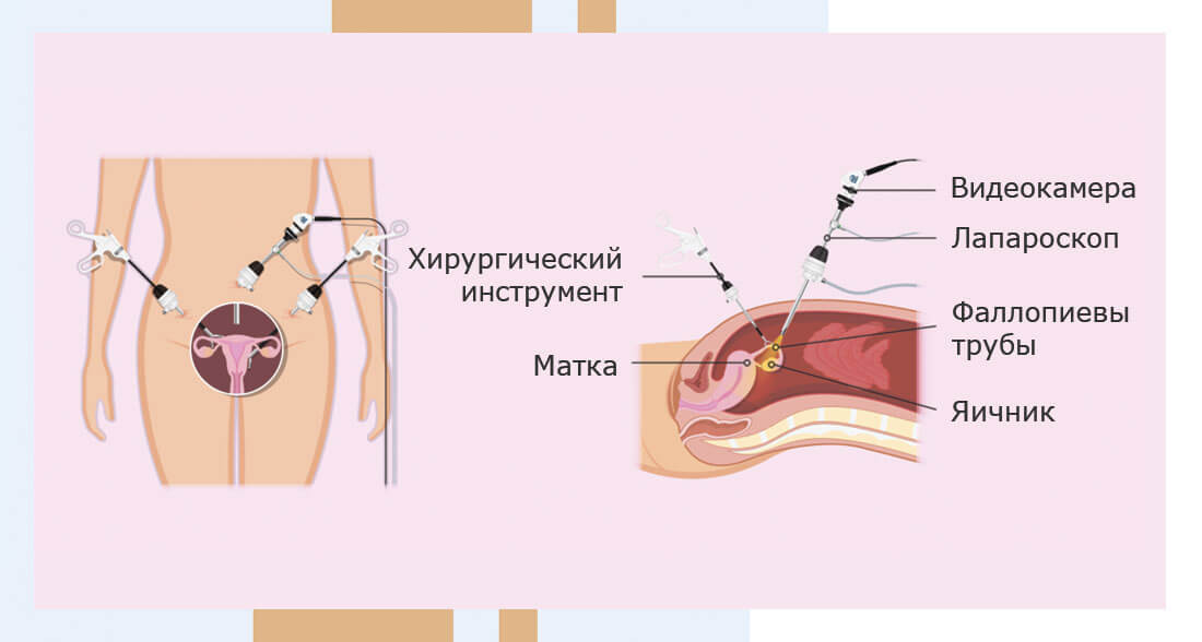 Хирургическое лечение - Изображение №3