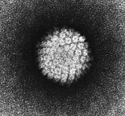 Причина РШМ