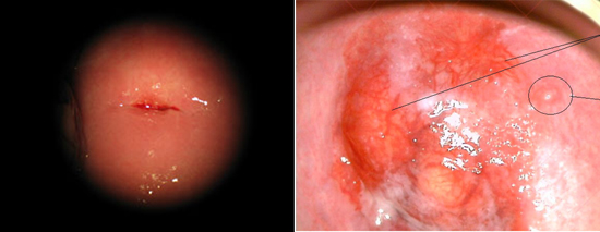 норма и РШМ