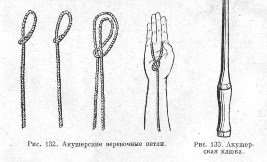 акушерские веревочные петли