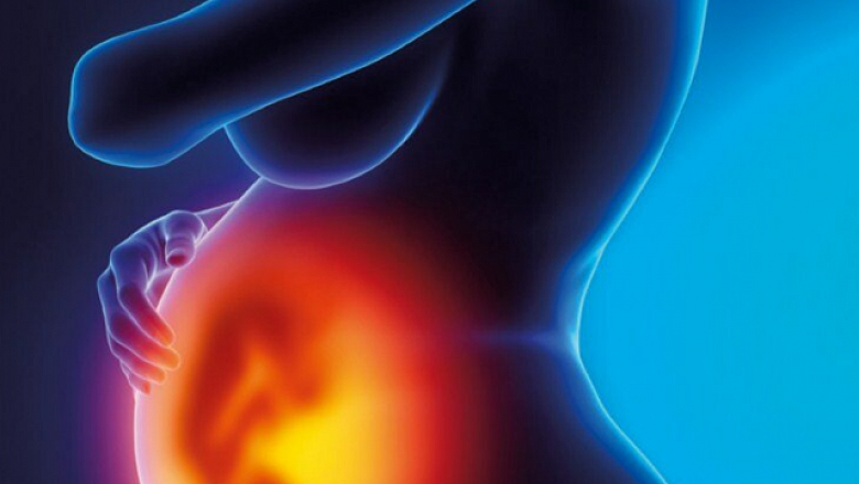 Миома матки и беременность