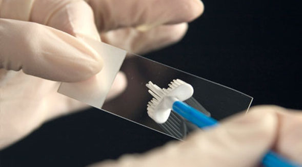 Что такое цитограмма шейки матки