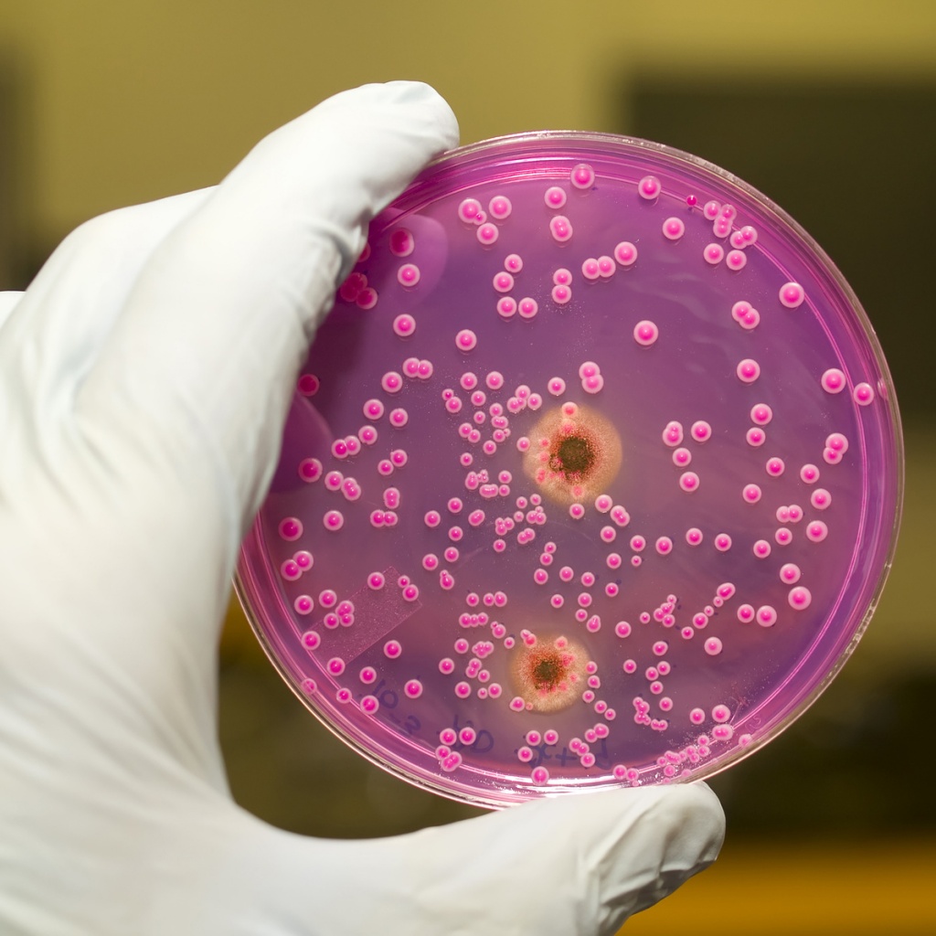 бактерия кандида.jpg