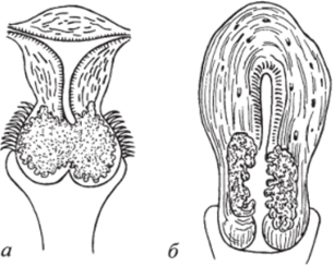 Рак шейки матки